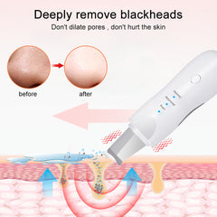 Ultrasonic Skin Scrubber Deep Face Cleaning